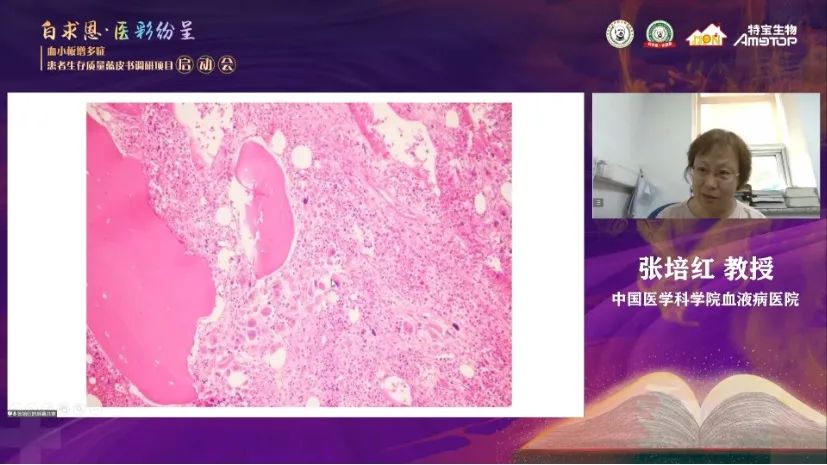 微信图片_20221017175108.jpg 张培红教授:骨髓增殖性肿瘤(MPN)的病理进展