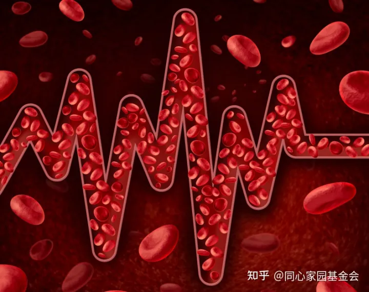 原发性血小板增多症能治好吗?诊疗进展如何?