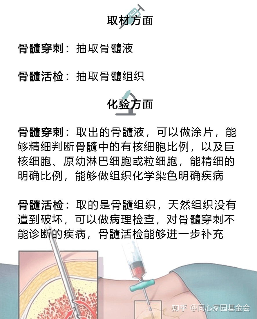 大咖零距离 | 骨髓活检知多少?刘清池教授为您一一解答