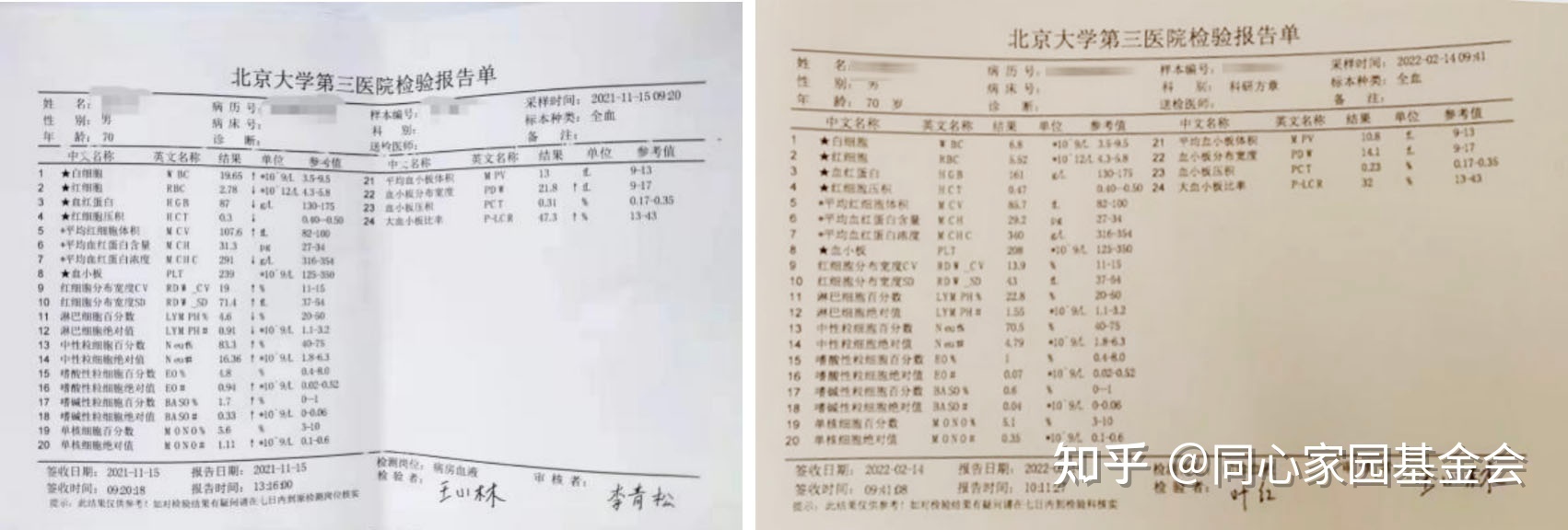 病友故事 | 从白血病到骨髓纤维化,峰回路转,终迎生命曙光