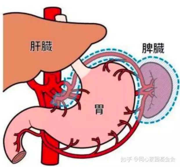 科普时间 | 脾脏“大”不如前,到底是谁惹的祸