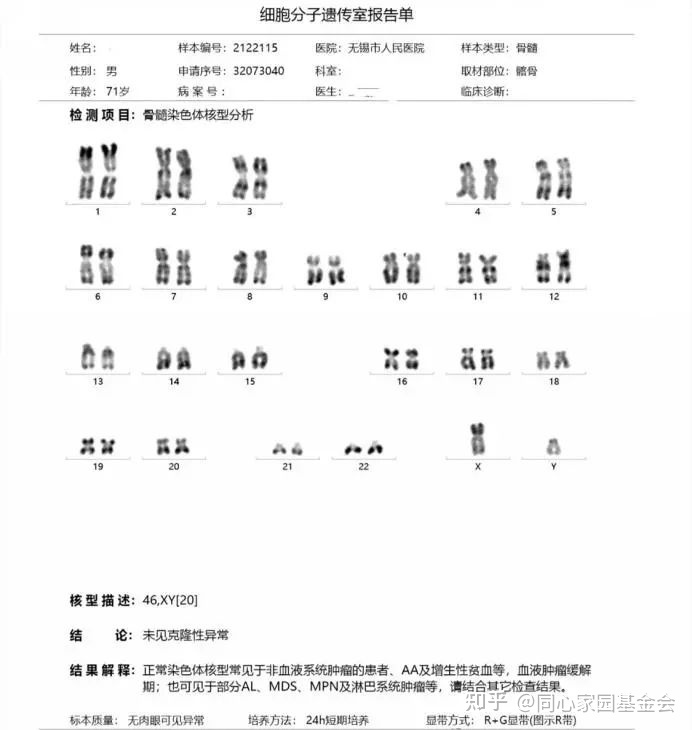 一例早期原发性骨髓纤维化的诊断历程