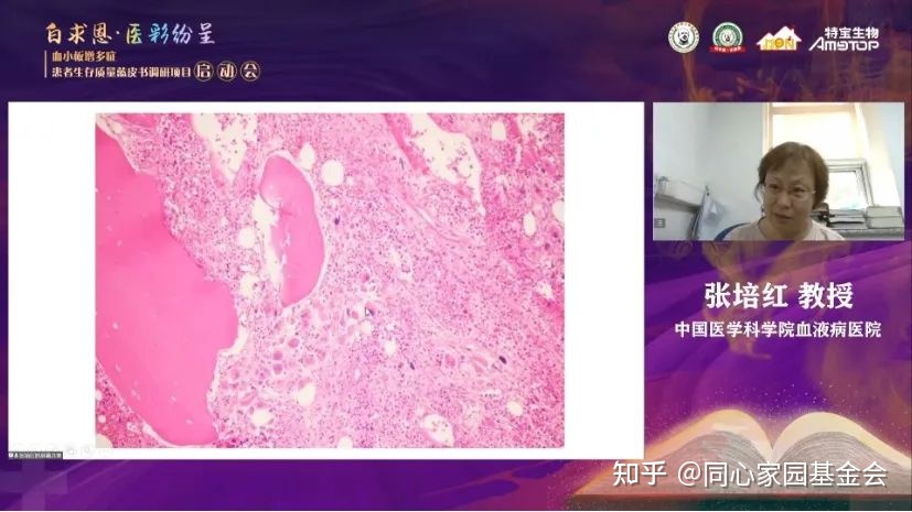 专家讲座|张培红教授:骨髓增殖性肿瘤(MPN)的病理展望