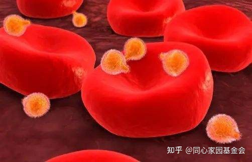 骨髓增生异常综合征(MDS)离白血病“不远”了吗?