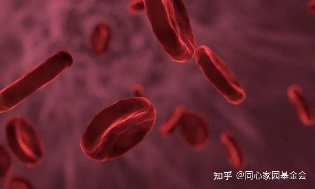 骨髓增生异常综合征(MDS)离白血病“不远”了吗?