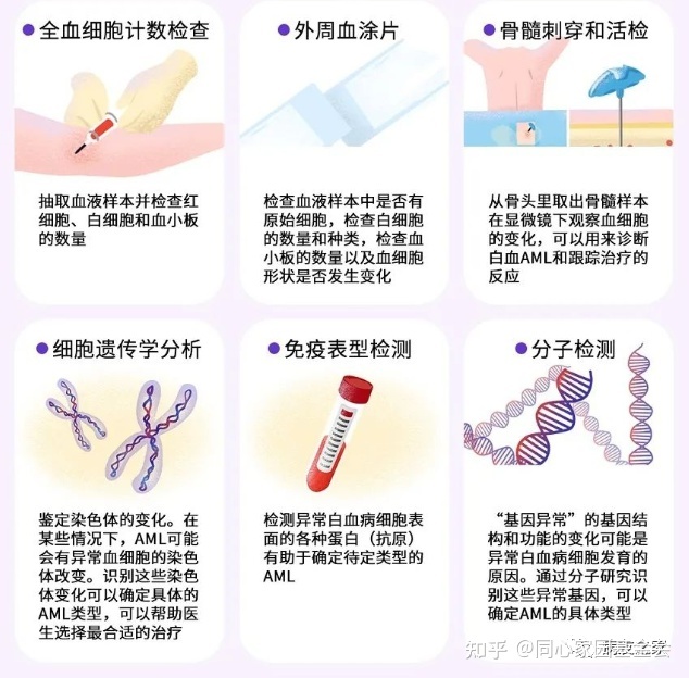 认识疾病 | 一文了解急性髓系白血病(AML)
