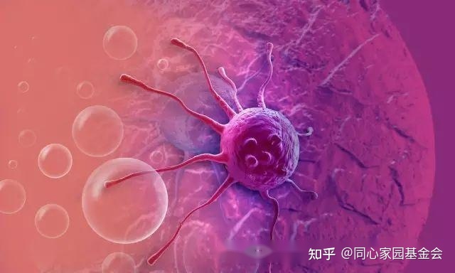 急性髓系白血病诊治进展变化多