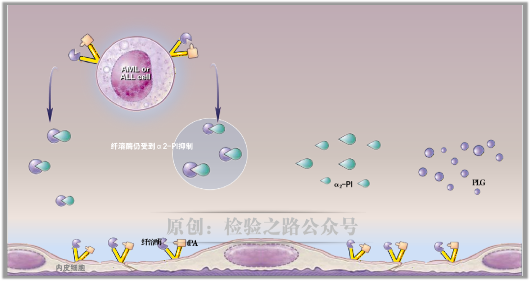 凝血知多少‖急性早幼粒细胞白血病(APL)出血之因 凝血知多少‖急性早幼粒细胞白血病(APL)出血之因