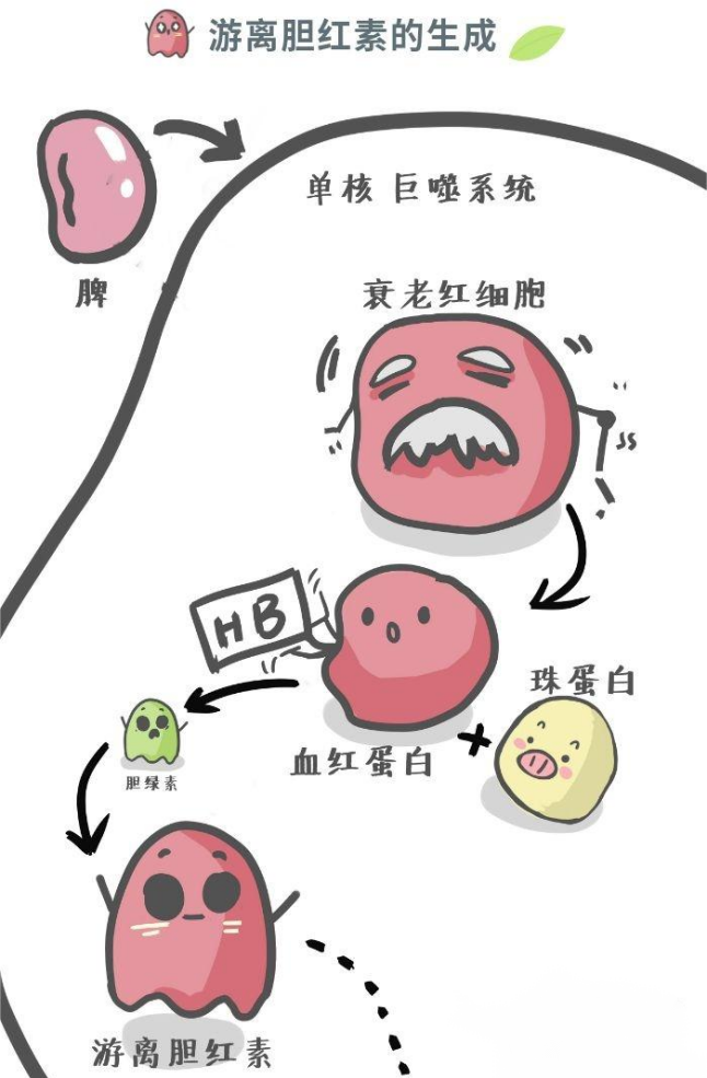科普时间 | 溶血性疾病患者更容易长胆结石吗? 科普时间 | 溶血性疾病患者更容易长胆结石吗?