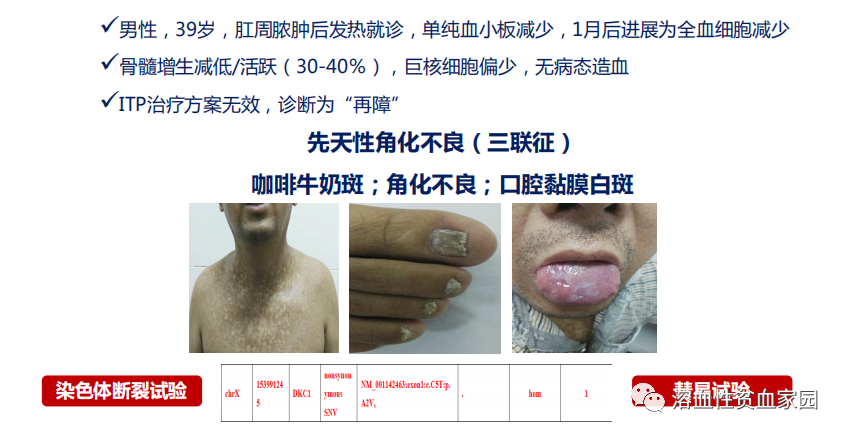 专家讲座 | 施均教授分享再生障碍性贫血(AA)诊治临床实践 专家讲座 | 施均教授分享再生障碍性贫血(AA)诊治临床实践