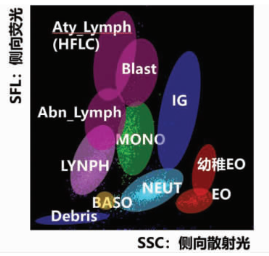 嗜酸性粒细胞增多的 10 大原因,最后一种很容易误诊! 嗜酸性粒细胞增多的 10 大原因,最后一种很容易误诊!
