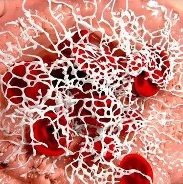 凝血因子的临床意义你了解吗?