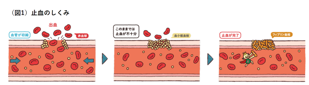 阻断血友病——让“玻璃人”不易碎 阻断血友病——让“玻璃人”不易碎
