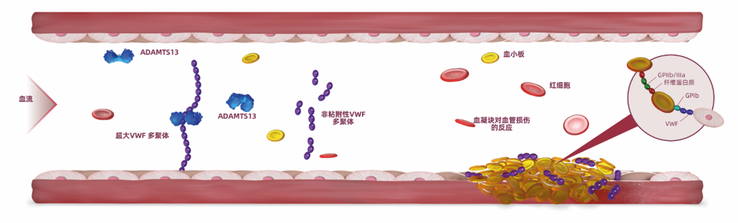 一文读懂:血栓性血小板减少性紫癜的发病机制及诊断流程 一文读懂:血栓性血小板减少性紫癜的发病机制及诊断流程