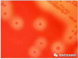 认识检查|血浆游离血红蛋白测定 认识检查|血浆游离血红蛋白测定