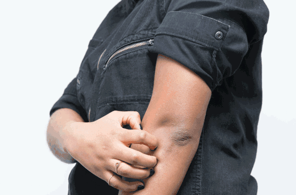 一起了解霍奇金淋巴瘤