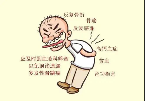 容易被误诊的血液肿瘤:多发性骨髓瘤 容易被误诊的血液肿瘤:多发性骨髓瘤