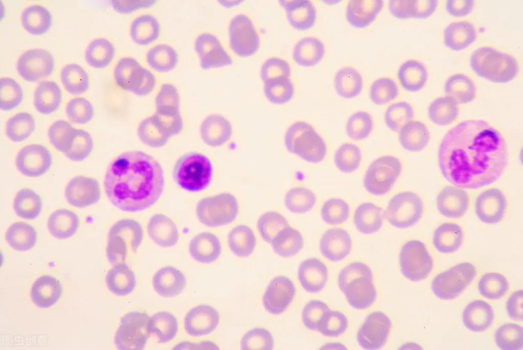 嗜酸性粒细胞升高是怎么回事? 嗜酸性粒细胞升高是怎么回事?