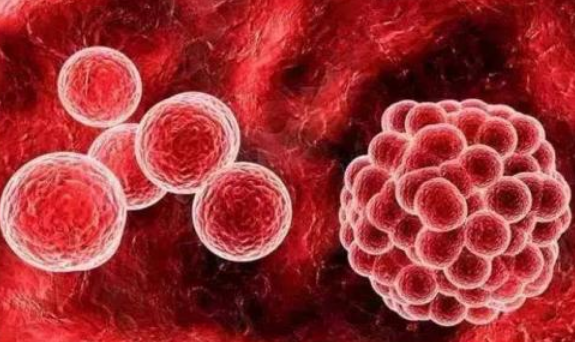 造血干细胞移植知多少？