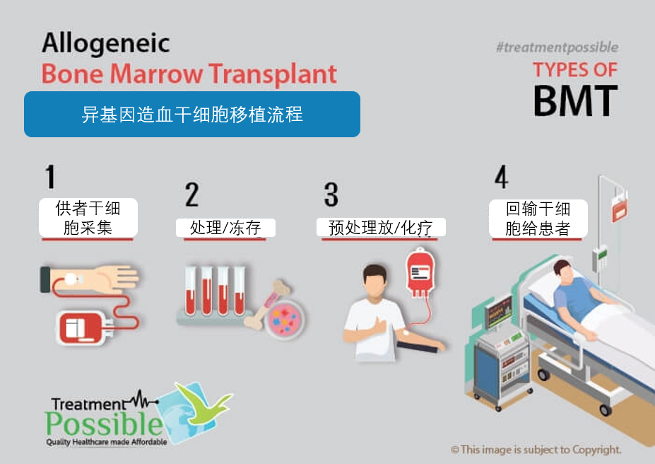 造血干细胞移植知多少？