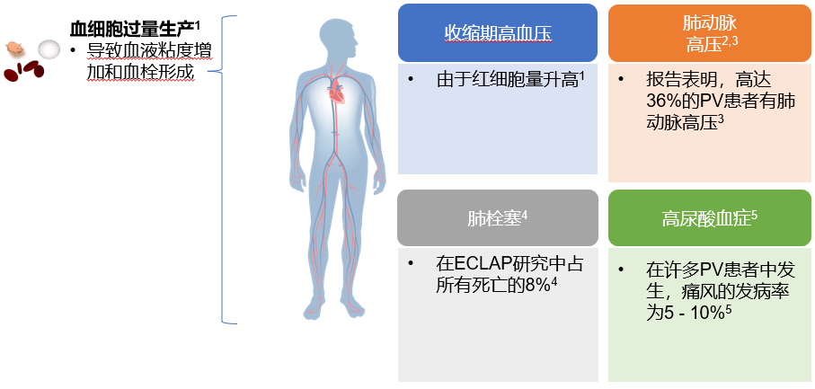 专家讲座 | 黄健教授:真性红细胞增多症诊治进展 专家讲座 | 黄健教授:真性红细胞增多症诊治进展