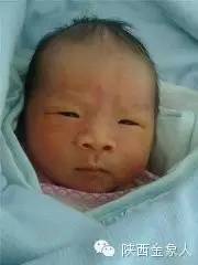 黄疸——当心是巨幼细胞性贫血惹的祸