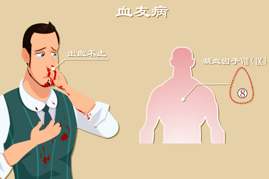 带您了解什么是血友病