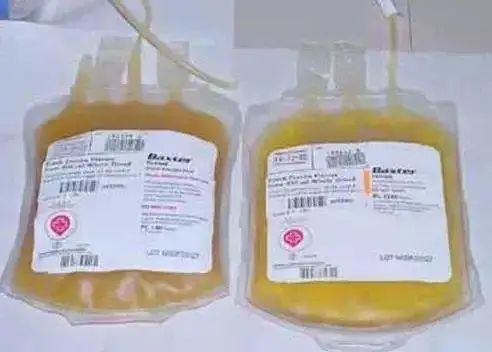 带你一起学习血栓性血小板减少性紫癜 带你一起学习血栓性血小板减少性紫癜