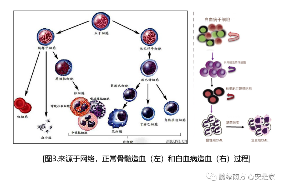 CML科普知识|什么是慢性髓系白血病？