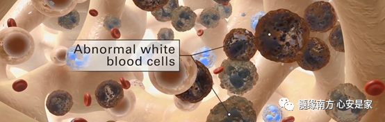 CML科普知识|什么是慢性髓系白血病？