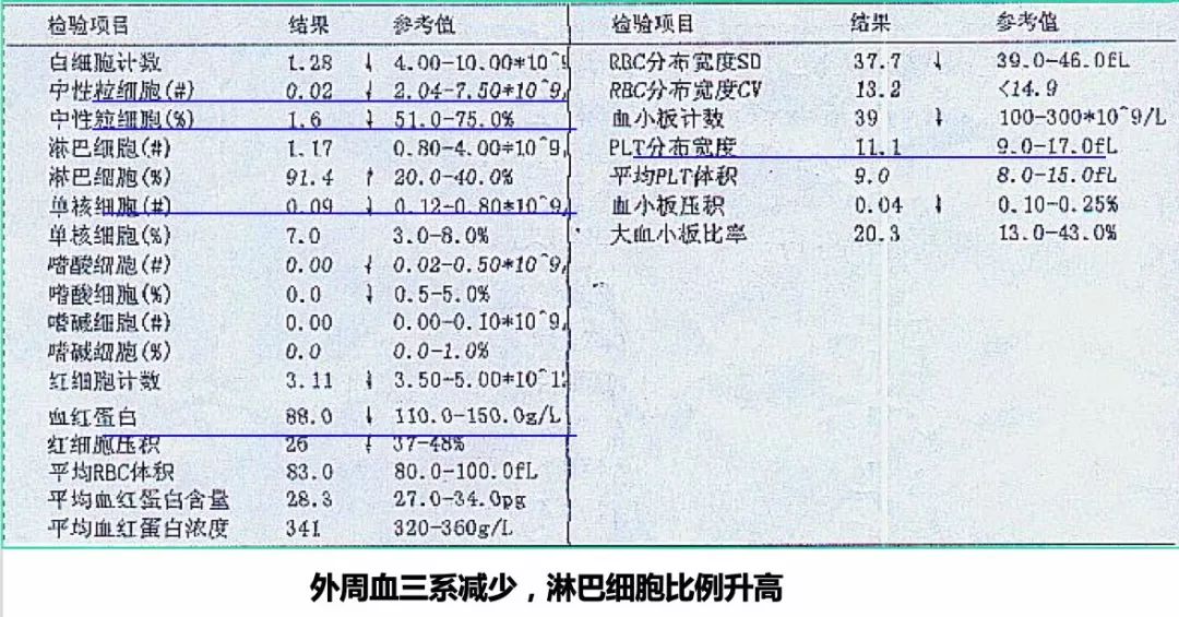 科普宣教 | 再生障碍性贫血 科普宣教 | 再生障碍性贫血