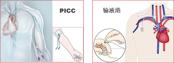 急性淋巴细胞白血病化疗需要多久?预后如何? 急性淋巴细胞白血病化疗需要多久?预后如何?