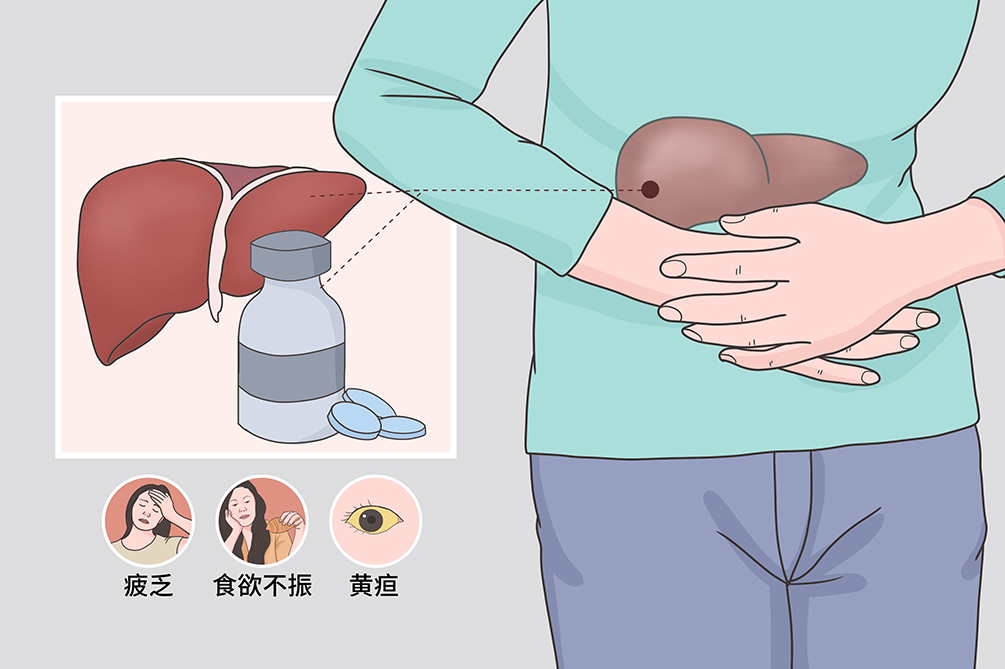 科普时间丨ITP患者用药易导致肝损伤，如何护肝？