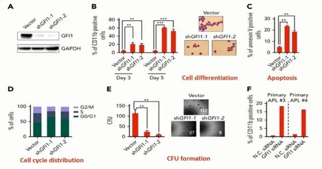 CSH 2020 | 陈竺院士：急性早幼粒细胞白血病发病原理、分型和治疗的最新认识