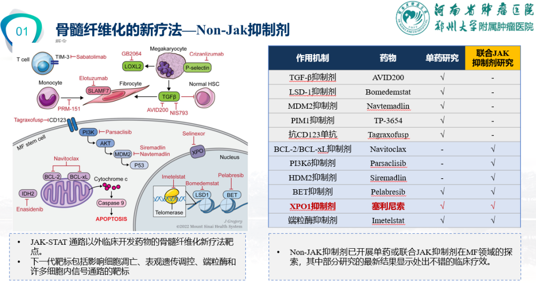 专家讲座 | 周虎教授:芦可替尼联合治疗加速期骨髓纤维化经验分享 专家讲座 | 周虎教授:芦可替尼联合治疗加速期骨髓纤维化经验分享