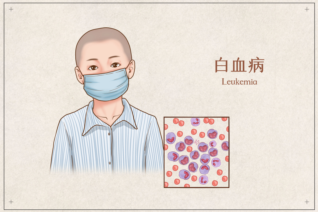 急性淋巴细胞白血病如何治疗? 急性淋巴细胞白血病如何治疗?