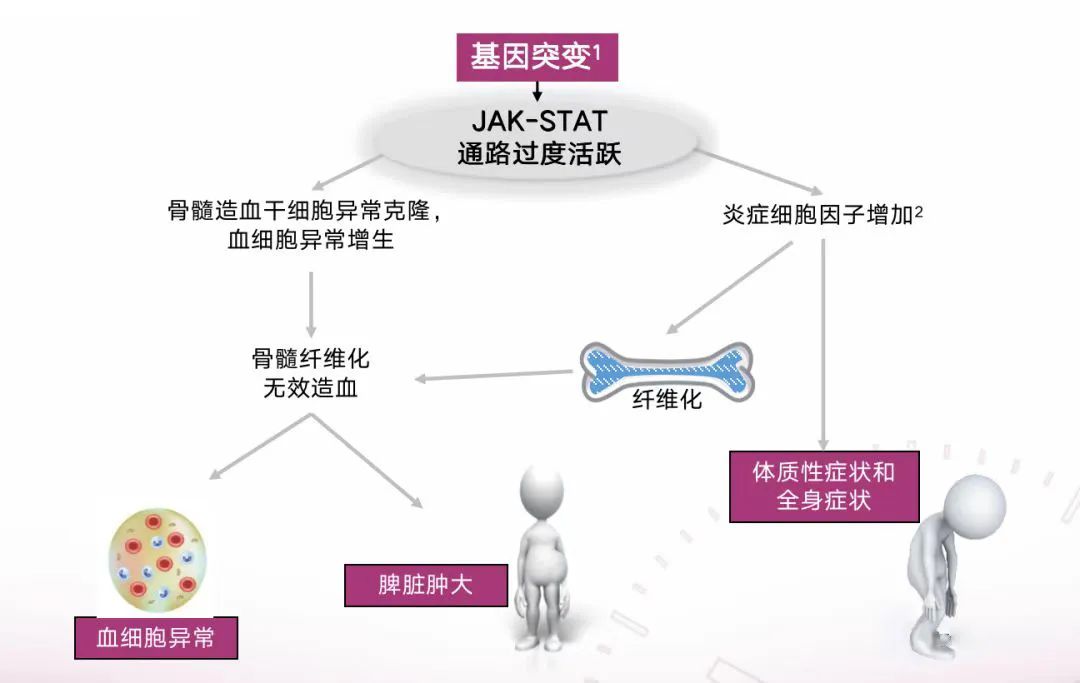 Q&amp;A | 原发性骨髓纤维化（PMF）的预后，我们应该了解什么呢？