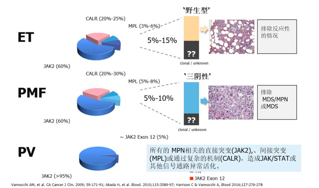 专家讲座 | 真性红细胞增多症（PV）的概述及最新进展（上）