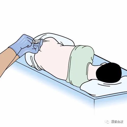 以“毒”为药?——关于急性早幼粒细胞白血病 以“毒”为药?——关于急性早幼粒细胞白血病