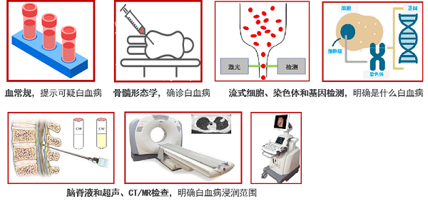 急性淋巴细胞白血病化疗需要多久?预后如何? 急性淋巴细胞白血病化疗需要多久?预后如何?