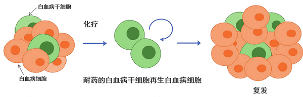 急性淋巴细胞白血病化疗需要多久?预后如何? 急性淋巴细胞白血病化疗需要多久?预后如何?