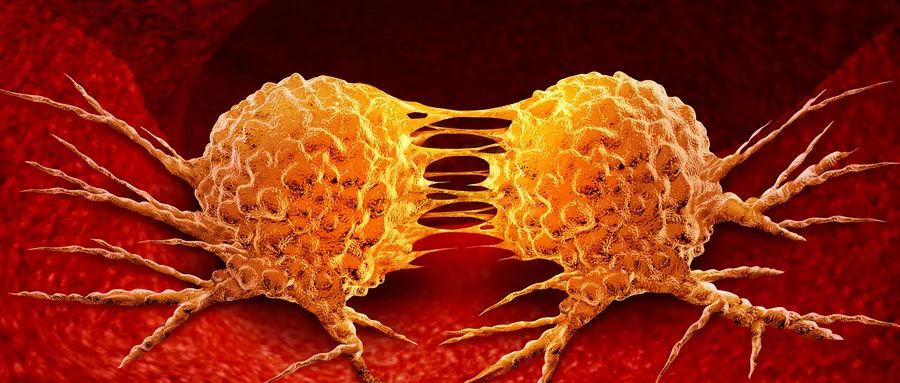 非霍奇金淋巴瘤是十大恶性肿瘤之一？罪魁祸首在这里！