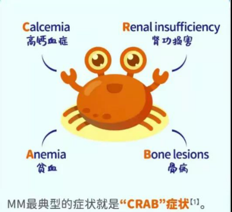 容易被误诊的血液肿瘤:多发性骨髓瘤 容易被误诊的血液肿瘤:多发性骨髓瘤