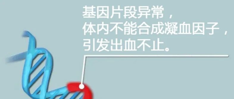 阻断血友病——让“玻璃人”不易碎