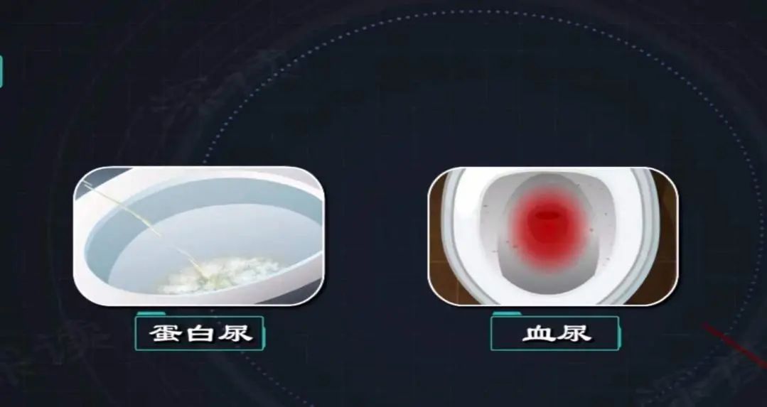 【健康科普】过敏性紫癜怎么办？