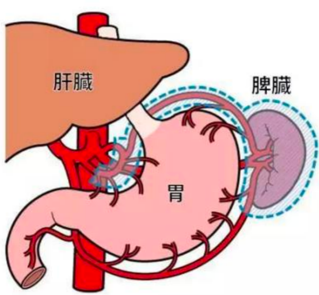 科普时间 | 脾脏“大”不如前,到底是谁惹的祸