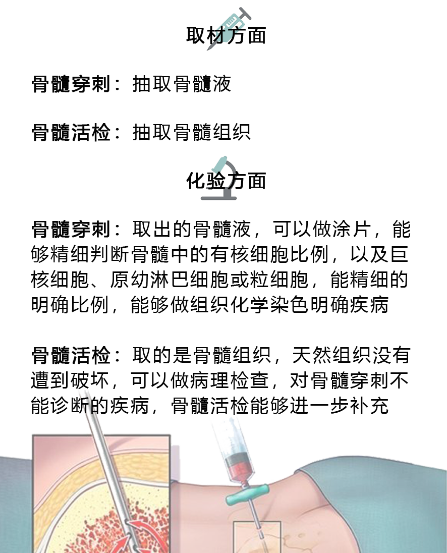大咖零距离 | 骨髓活检知多少?刘清池教授为您一一解答