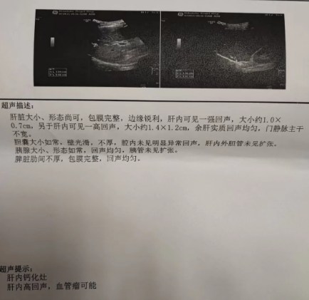 大咖谈病例 | 张敬宇教授:一例真性红细胞增多症的病例点评