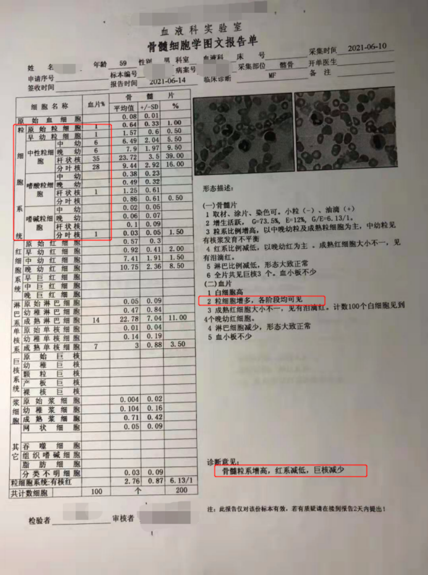 科普时间 | 这样看骨穿报告,医生懂得您也懂
