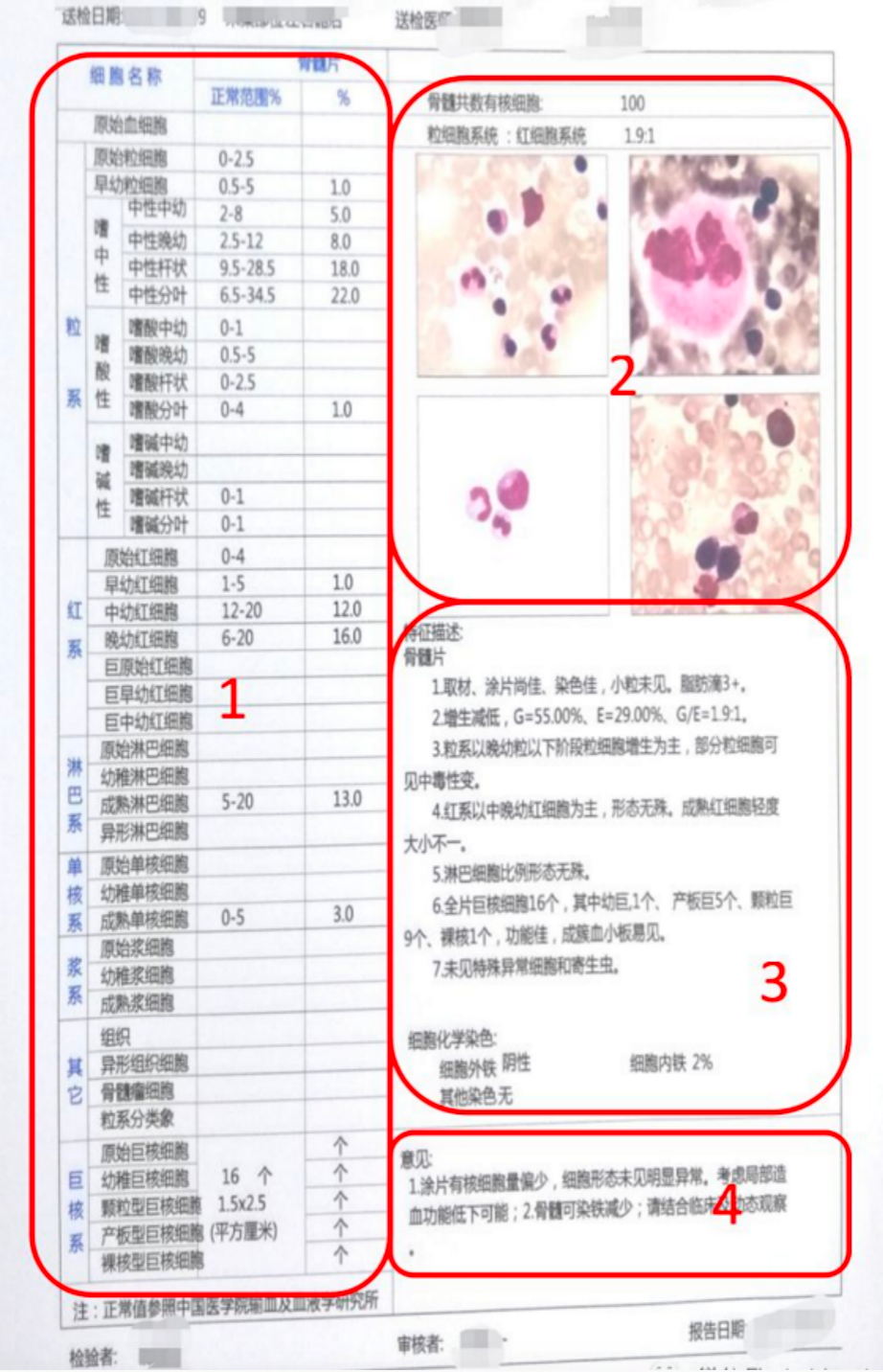 科普时间 | 这样看骨穿报告,医生懂得您也懂
